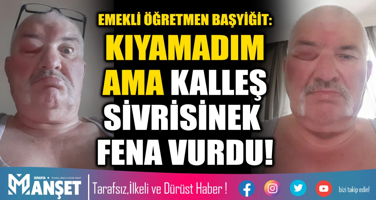 EMEKLİ &Ouml;ĞRETMEN BAŞYİĞİT: KIYAMADIM AMA KALLEŞ SİVRİSİNEK FENA VURDU!